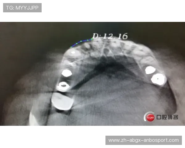 勇士队利好科尔称穆迪伤情仅限髌腱未伤及软骨骨头简化手术 勇士队利好科尔称穆迪伤情仅限髌腱未伤及软骨骨头简化手术